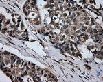 GBE1 Antibody in Immunohistochemistry (Paraffin) (IHC (P))