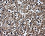 GBE1 Antibody in Immunohistochemistry (Paraffin) (IHC (P))