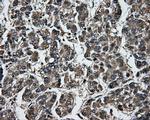 GBE1 Antibody in Immunohistochemistry (Paraffin) (IHC (P))