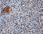 GBE1 Antibody in Immunohistochemistry (Paraffin) (IHC (P))