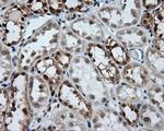 GBE1 Antibody in Immunohistochemistry (Paraffin) (IHC (P))