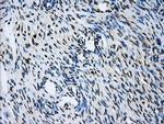 GBE1 Antibody in Immunohistochemistry (Paraffin) (IHC (P))