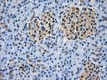 GBE1 Antibody in Immunohistochemistry (Paraffin) (IHC (P))