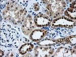 GBE1 Antibody in Immunohistochemistry (Paraffin) (IHC (P))