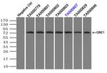 GBE1 Antibody in Immunoprecipitation (IP)