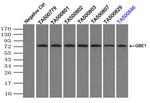 GBE1 Antibody in Immunoprecipitation (IP)