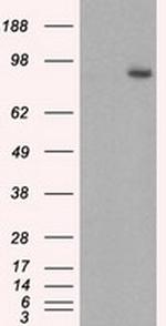 GBE1 Antibody in Western Blot (WB)