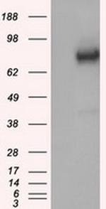 GBE1 Antibody in Western Blot (WB)