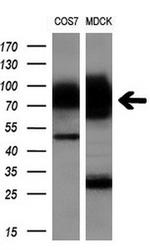 GBE1 Antibody in Western Blot (WB)