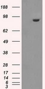 GBE1 Antibody in Western Blot (WB)