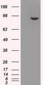 GBE1 Antibody in Western Blot (WB)