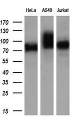 GBE1 Antibody in Western Blot (WB)