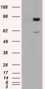 GBE1 Antibody in Western Blot (WB)