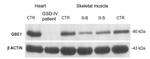 GBE1 Antibody in Western Blot (WB)