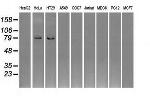 GBE1 Antibody in Western Blot (WB)