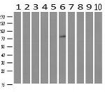 GBE1 Antibody in Western Blot (WB)