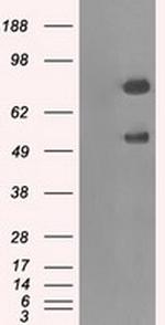 GBE1 Antibody in Western Blot (WB)