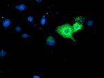 GBP1 Antibody in Immunocytochemistry (ICC/IF)