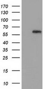 GBP5 Antibody in Western Blot (WB)