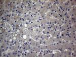 GC Antibody in Immunohistochemistry (Paraffin) (IHC (P))