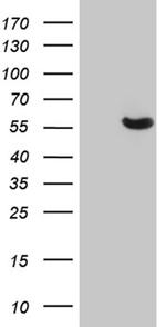 GC Antibody in Western Blot (WB)