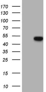 GC Antibody in Western Blot (WB)