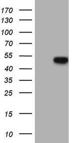 GC Antibody in Western Blot (WB)