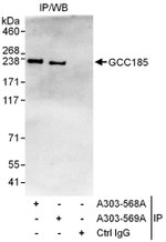 GCC185 Antibody in Immunoprecipitation (IP)