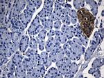 GCH1 Antibody in Immunohistochemistry (Paraffin) (IHC (P))