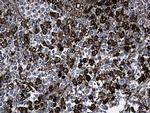 GCH1 Antibody in Immunohistochemistry (Paraffin) (IHC (P))