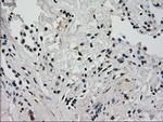 GCK Antibody in Immunohistochemistry (Paraffin) (IHC (P))