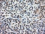 GCK Antibody in Immunohistochemistry (Paraffin) (IHC (P))