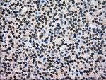 GCK Antibody in Immunohistochemistry (Paraffin) (IHC (P))