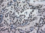 GCK Antibody in Immunohistochemistry (Paraffin) (IHC (P))