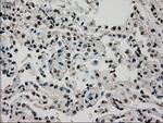 GCK Antibody in Immunohistochemistry (Paraffin) (IHC (P))