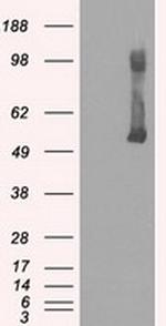 GCK Antibody in Western Blot (WB)