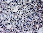 GCKR Antibody in Immunohistochemistry (Paraffin) (IHC (P))