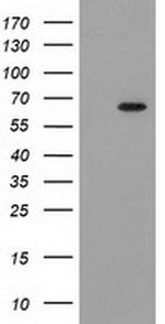 GCKR Antibody in Western Blot (WB)