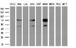 GCKR Antibody in Western Blot (WB)