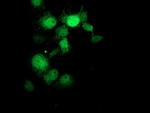 GDAP1L1 Antibody in Immunocytochemistry (ICC/IF)