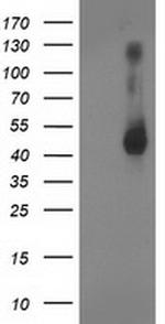 GDAP1L1 Antibody in Western Blot (WB)