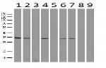 GEMIN8 Antibody in Western Blot (WB)