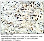 GFAP Antibody in Immunohistochemistry (IHC)