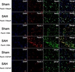 GFAP Antibody in Immunohistochemistry (IHC)