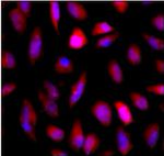 GFP Antibody in Immunocytochemistry (ICC/IF)