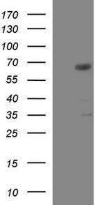 GGA2 Antibody in Western Blot (WB)