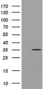 GGPS1 Antibody in Western Blot (WB)