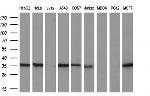 GGPS1 Antibody in Western Blot (WB)