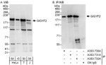 GIGYF2 Antibody in Western Blot (WB)