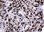 GLB1 Antibody in Immunohistochemistry (Paraffin) (IHC (P))